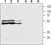 Anti-Human CysLTR2 (extracellular) Antibody