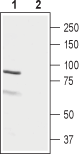 LH Receptor/LHCGR (extracellular) Blocking Peptide