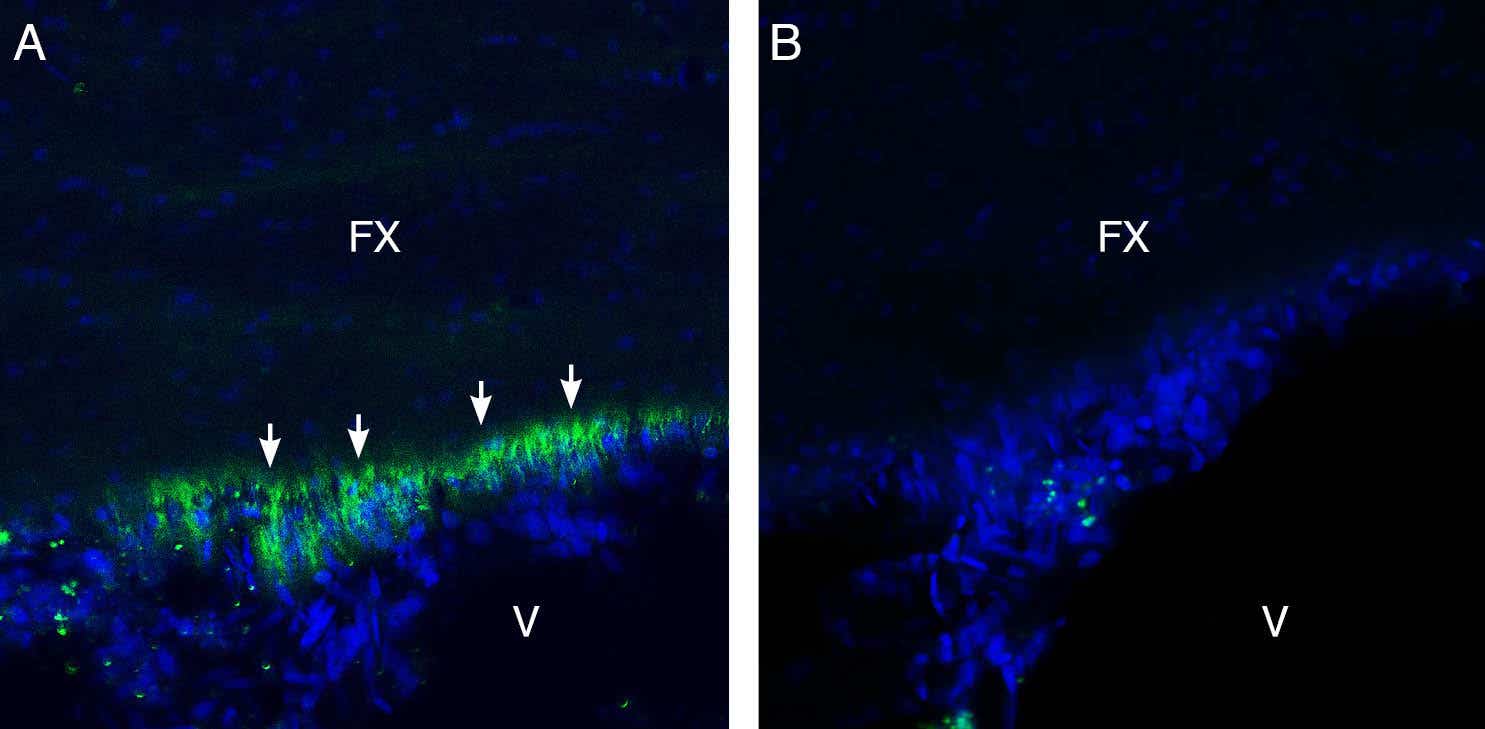 Anti-GP130 (extracellular) Antibody