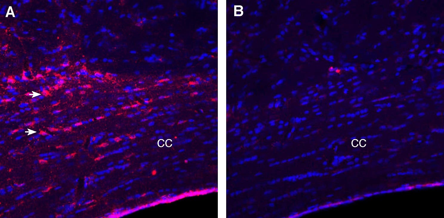 Anti-LPAR1 (EDG2) (extracellular) Antibody