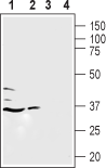 Anti-Human LPAR5 (extracellular) Antibody