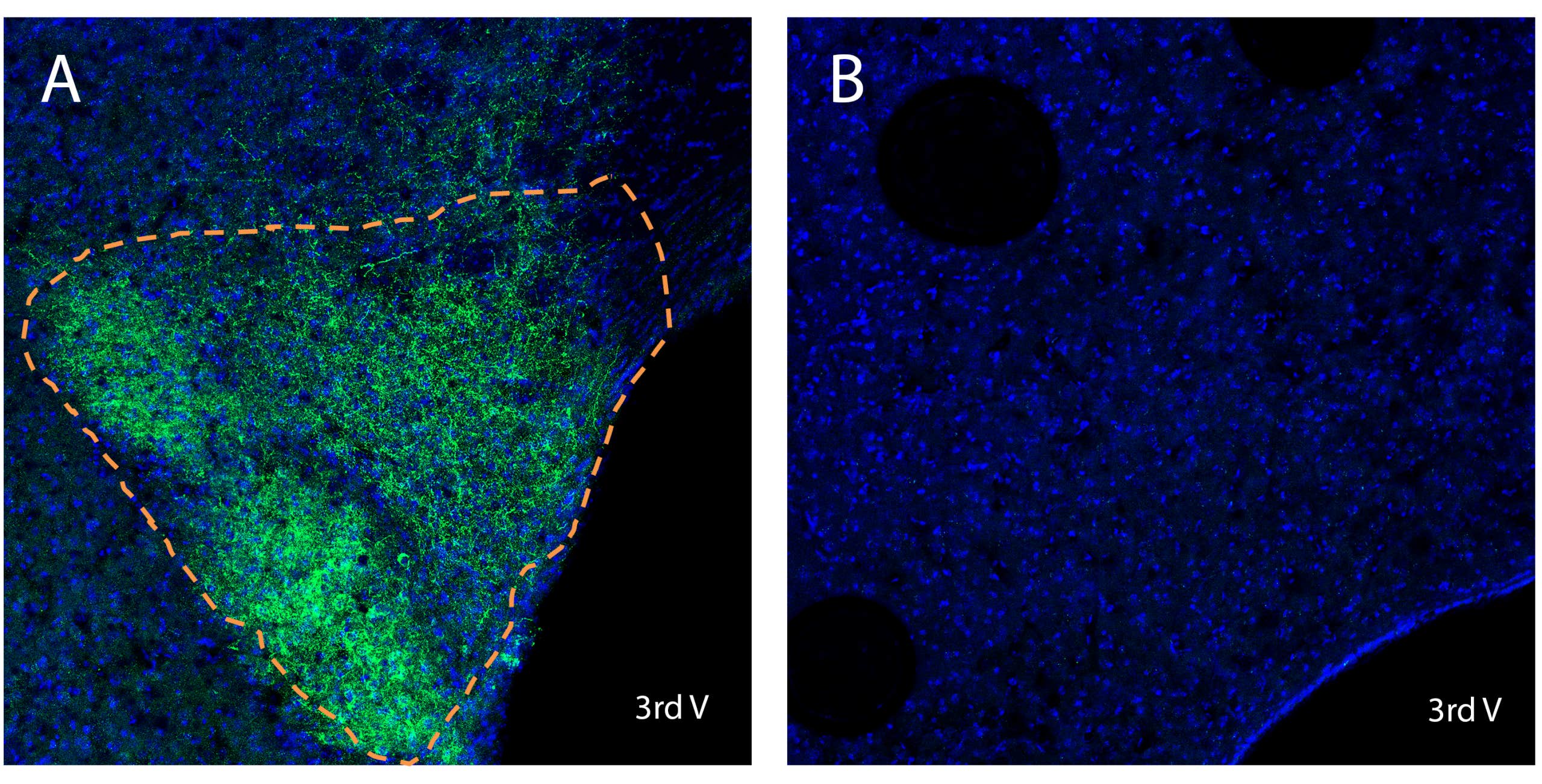 Anti-LPAR6 (P2RY5) (extracellular) Antibody