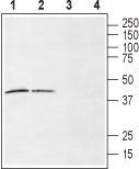 LPAR6/P2RY5 (extracellular) Blocking Peptide