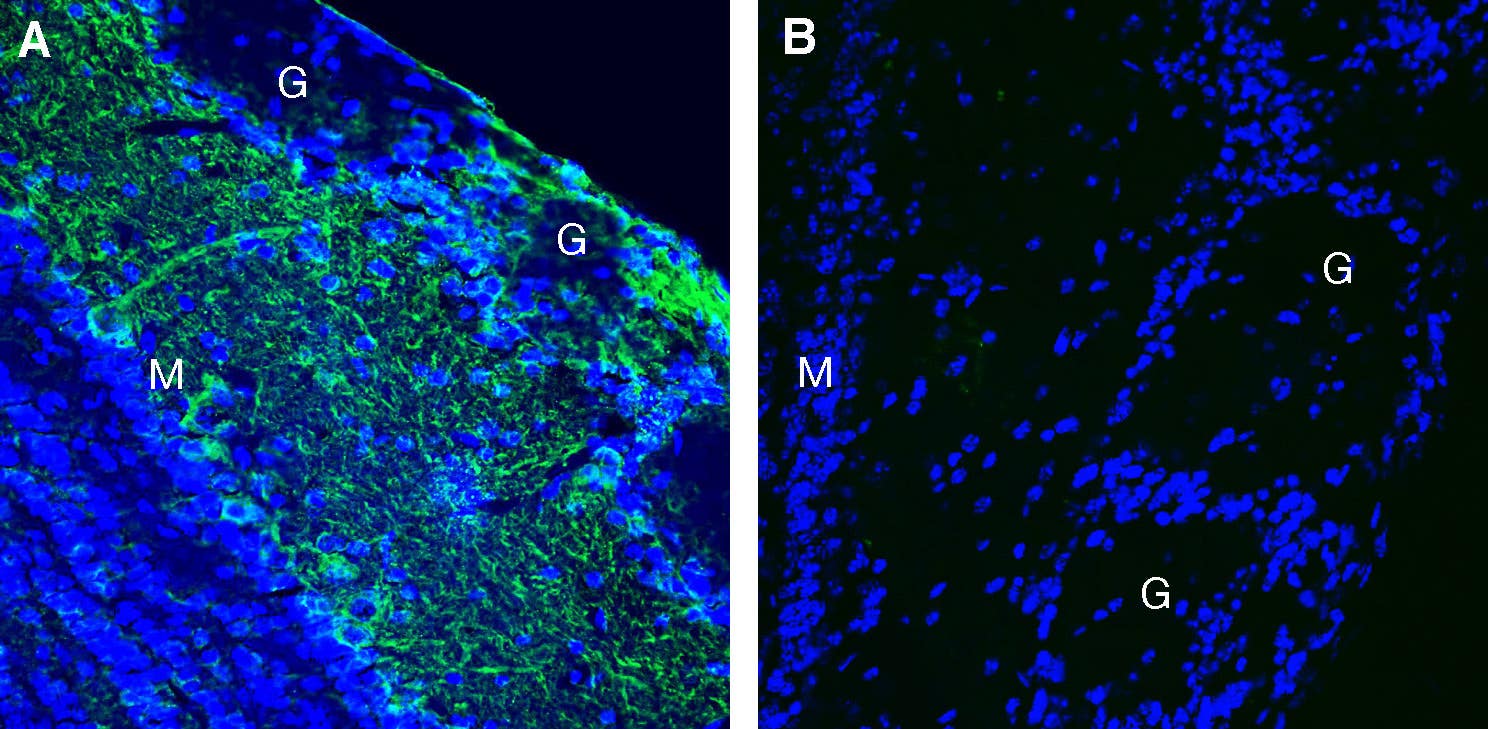 Anti-Leptin Receptor (extracellular) Antibody