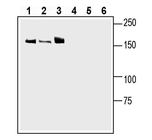 Leptin Receptor (extracellular) Blocking Peptide