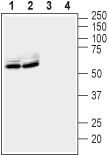 Anti-LGI1 Antibody