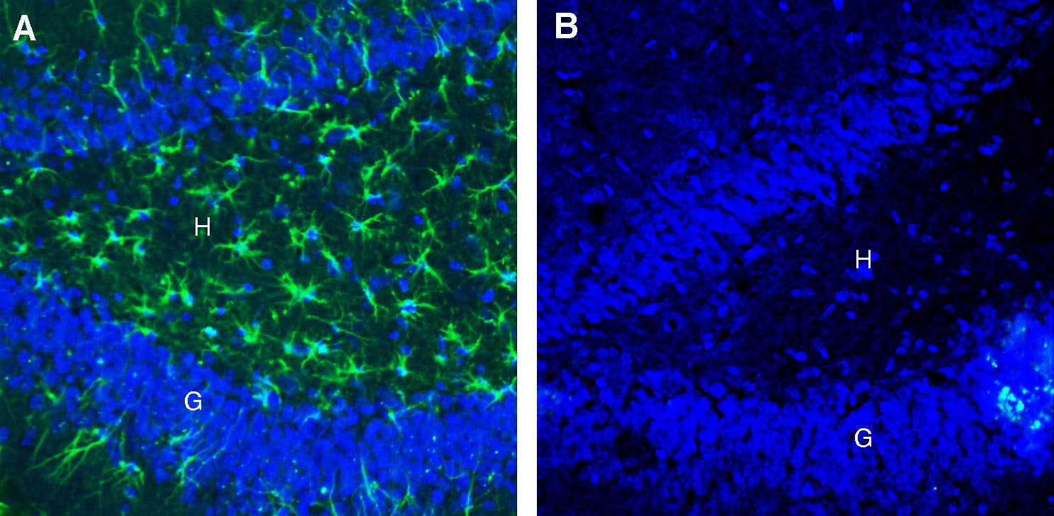 Anti-CLEC7A/Dectin-1 (extracellular) Antibody