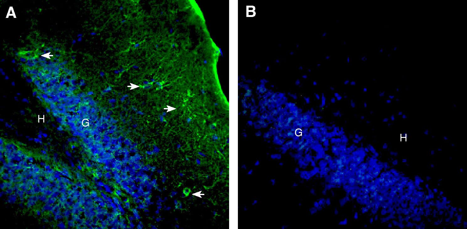 Anti-Latrophilin-3 (extracellular) Antibody
