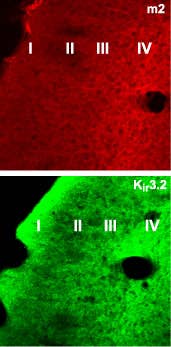 Anti-CHRM2 Antibody
