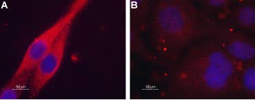 Anti-CHRM4 Antibody