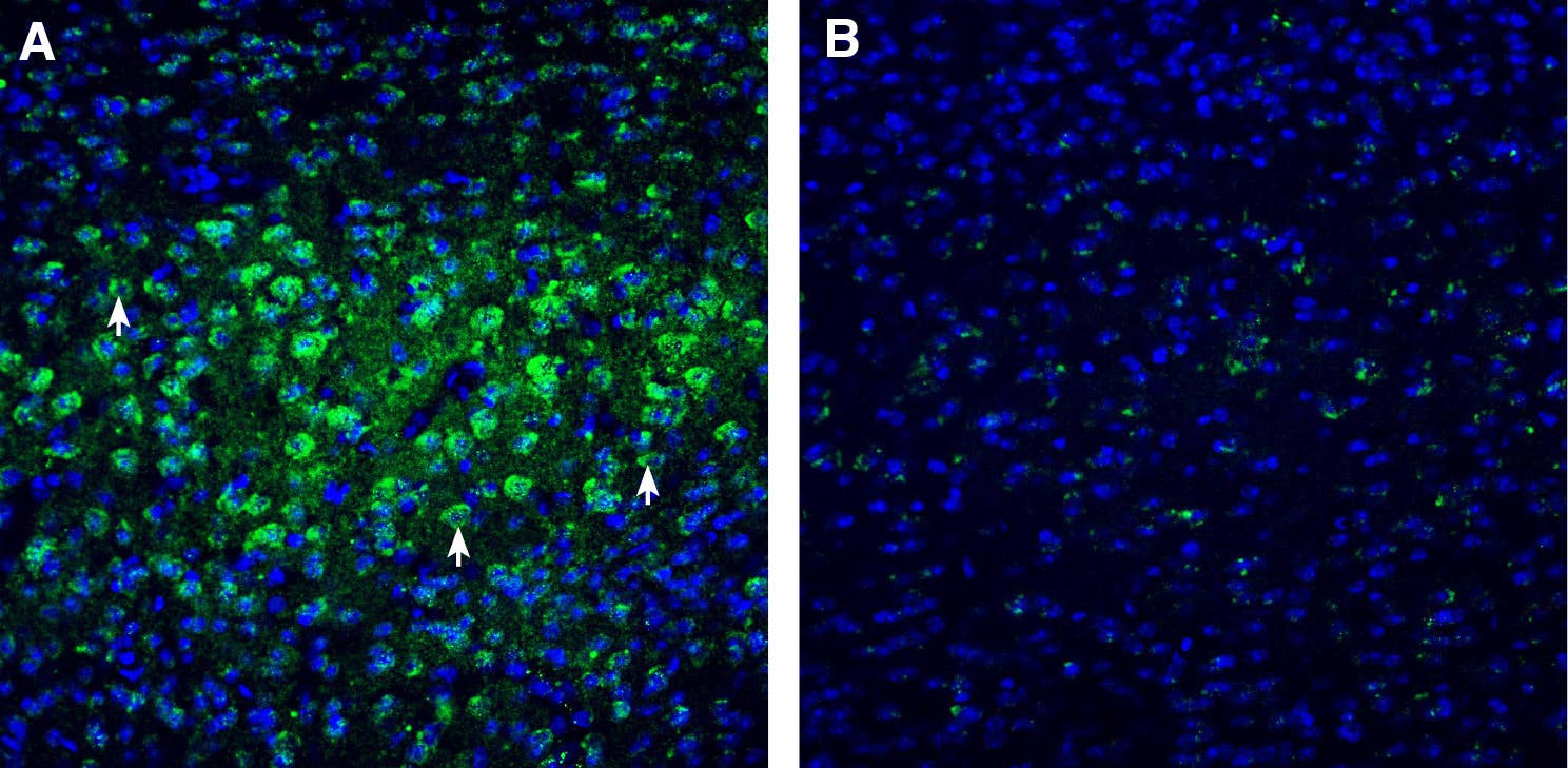 Anti-CHRM3 Antibody