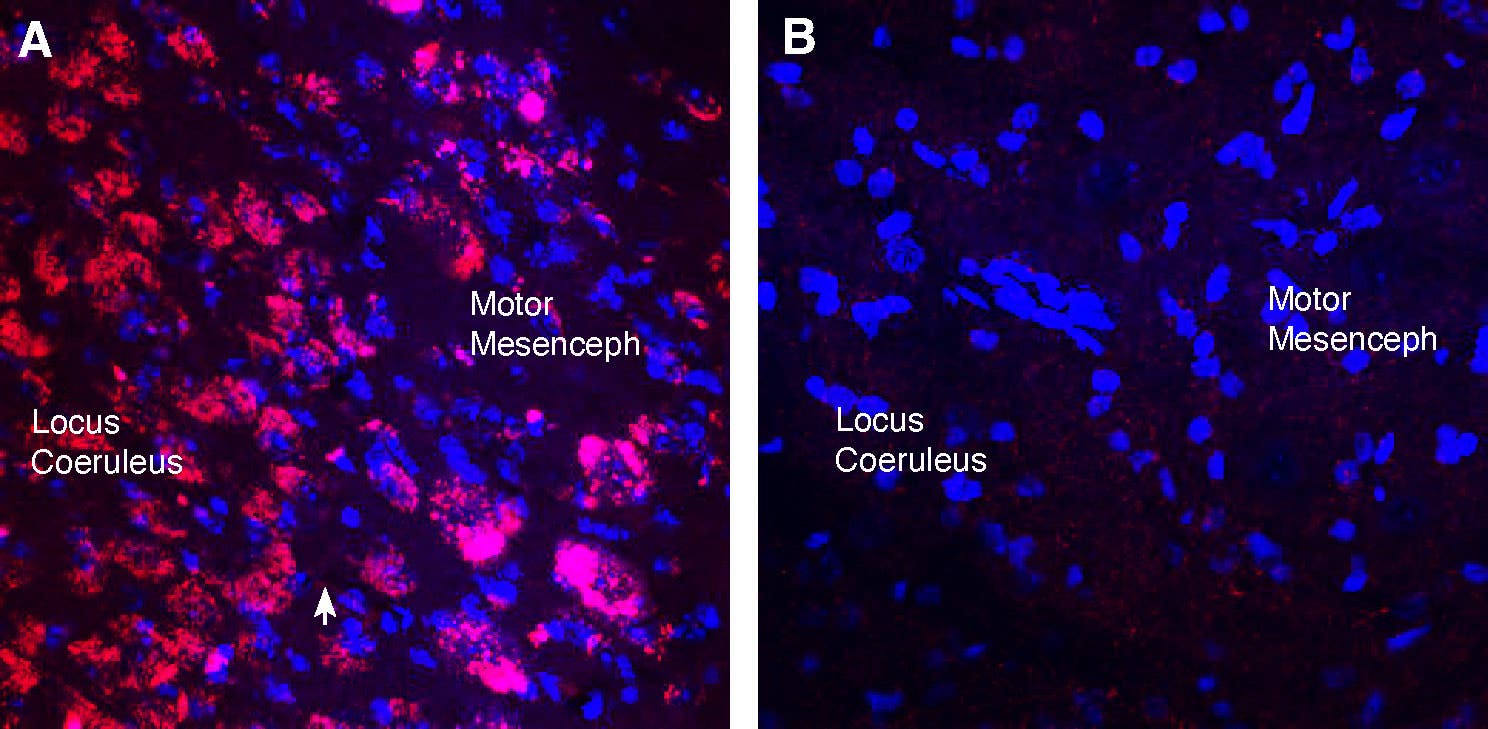 Guinea Pig Anti-CHRM3 Antibody