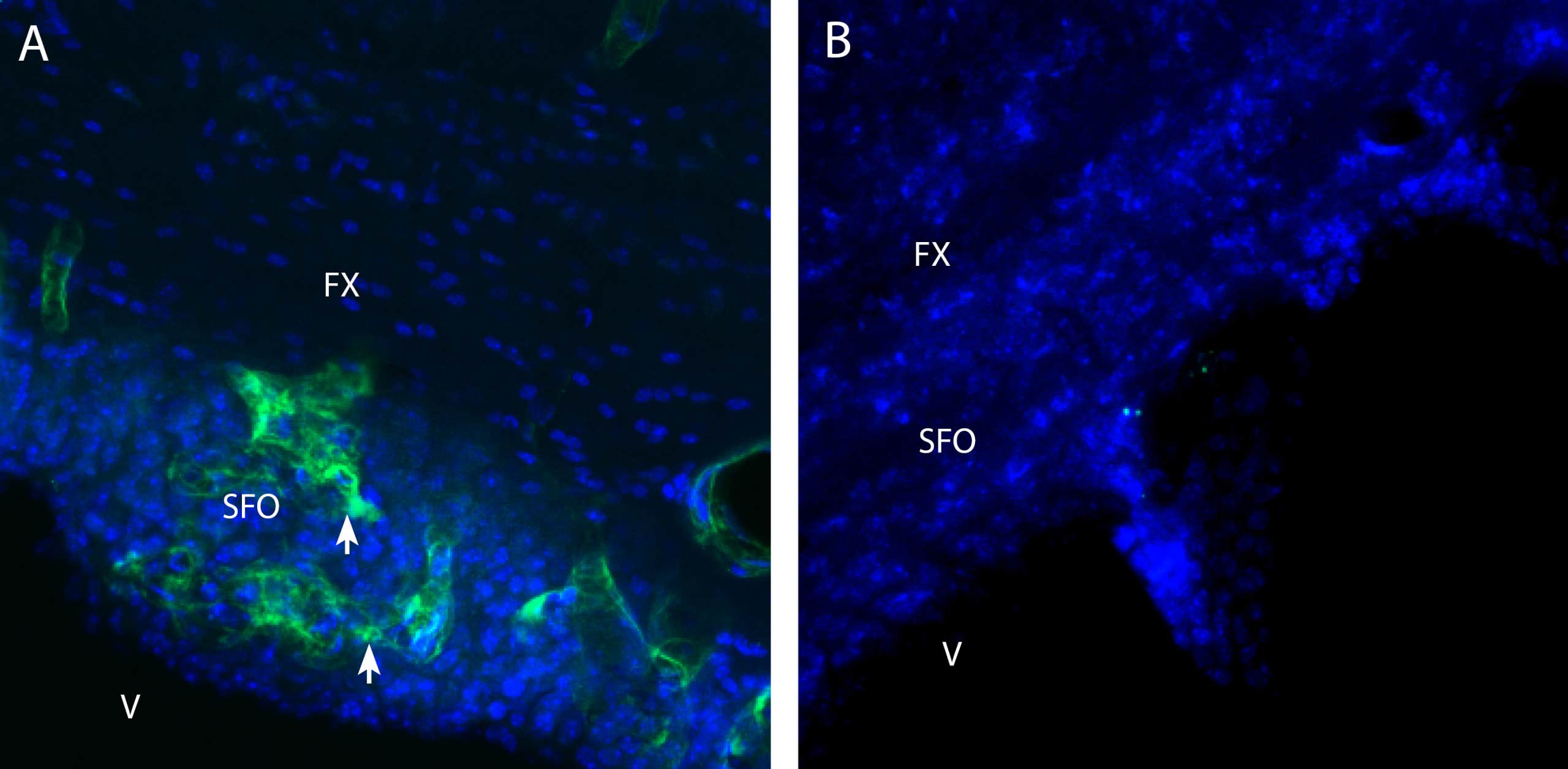 Anti-CHRM3 (extracellular) Antibody