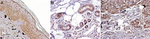 Anti-MC1 Receptor Antibody