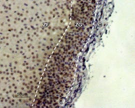 Anti-MC2 Receptor (extracellular) Antibody