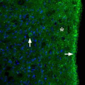 Anti-MC3 Receptor (extracellular) Antibody