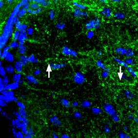 Anti-MC4 Receptor (extracellular) Antibody