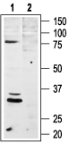 MC4 Receptor (extracellular) Blocking Peptide