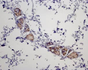 Anti-MC5 Receptor Antibody