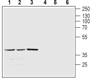 Melatonin Receptor 1A/MTNR1A Blocking Peptide