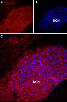 Anti-Melatonin Receptor 1A (MTNR1A) Antibody