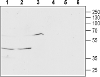 MCHR1 (extracellular) Blocking Peptide
