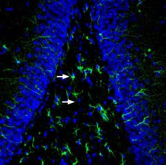 Anti-MRGPRE Antibody