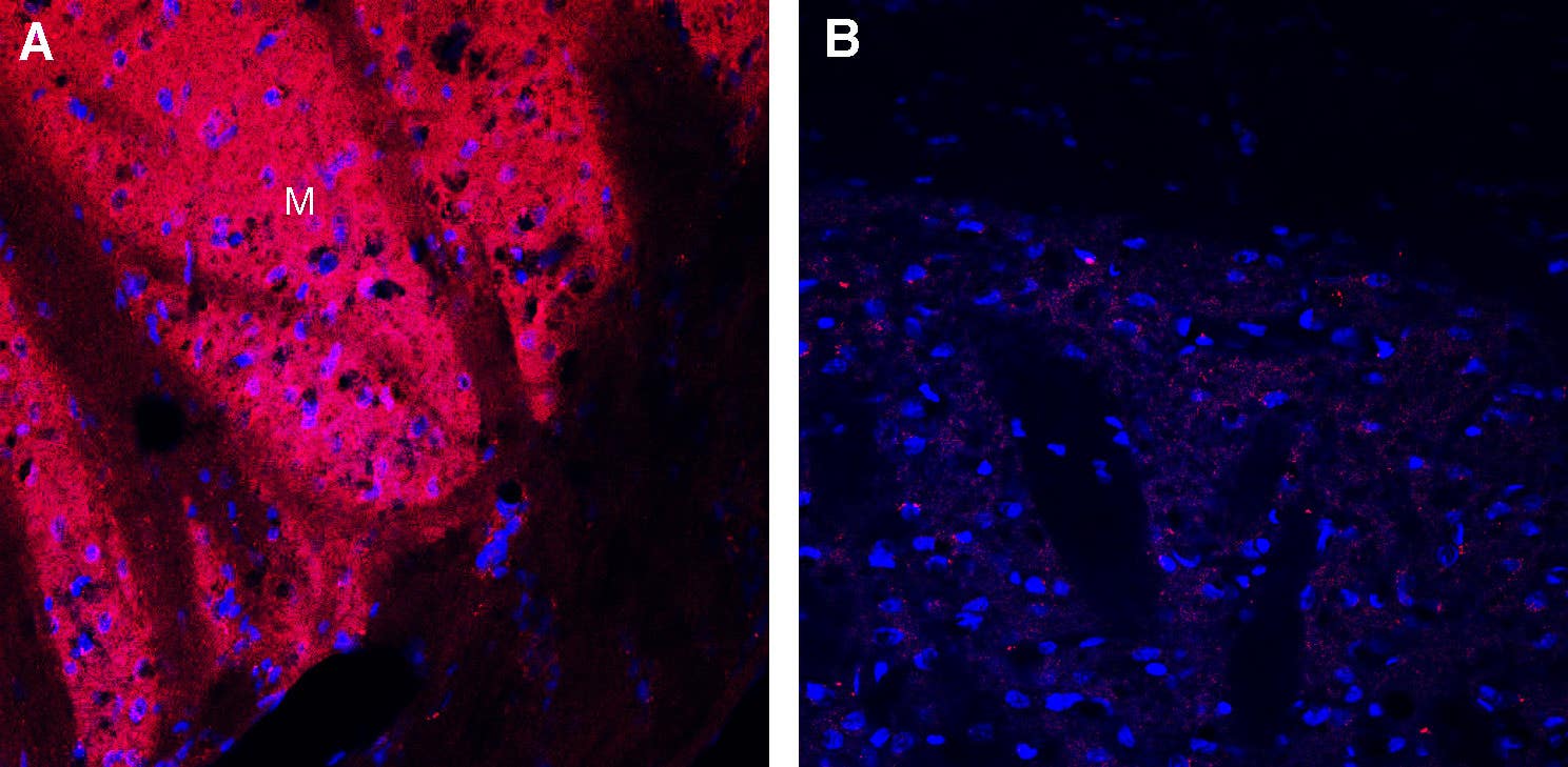 Guinea Pig Anti-Dopamine Transporter (DAT) (extracellular) Antibody