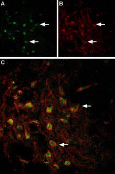 Anti-VMAT2-ATTO Fluor-488 Antibody