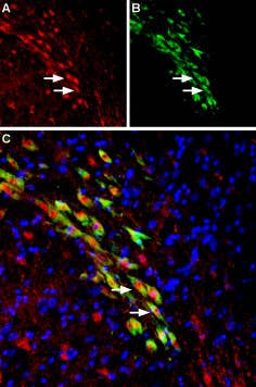 Anti-VMAT2 Antibody