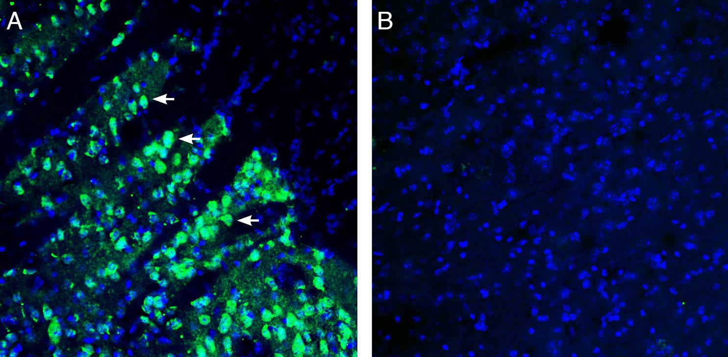 Anti-SLC18B1 (VPAT) Antibody