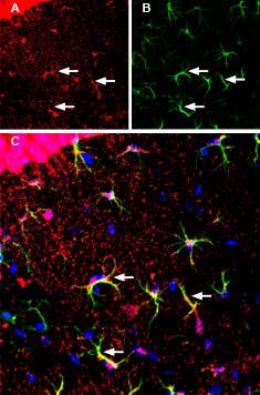 Anti-MCT1 (SLC16A1) (extracellular) Antibody