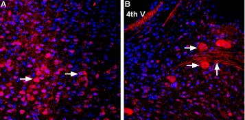 Anti-MCT2 Antibody