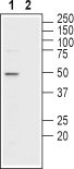 MCT2 Blocking Peptide