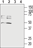 Anti-MCT4 (SLC16A3) Antibody