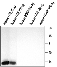 NGF Blocking Peptide