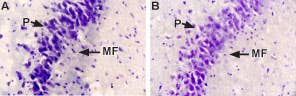 Anti-NGF Antibody