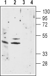 Anti-Nicotinic Acetylcholine Receptor α1 (CHRNA1) (extracellular) Antibody