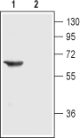 Nicotinic Acetylcholine Receptor α3/CHRNA3 (extracellular) Blocking Peptide