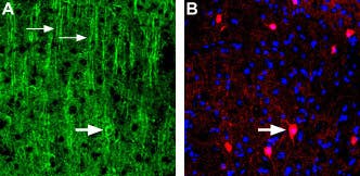 Anti-Nicotinic Acetylcholine Receptor α3 (CHRNA3) (extracellular) Antibody