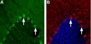 Anti-Nicotinic Acetylcholine Receptor α4 (CHRNA4) (extracellular) Antibody