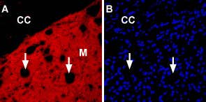 Anti-Nicotinic Acetylcholine Receptor α6 (CHRNA6) (extracellular) Antibody