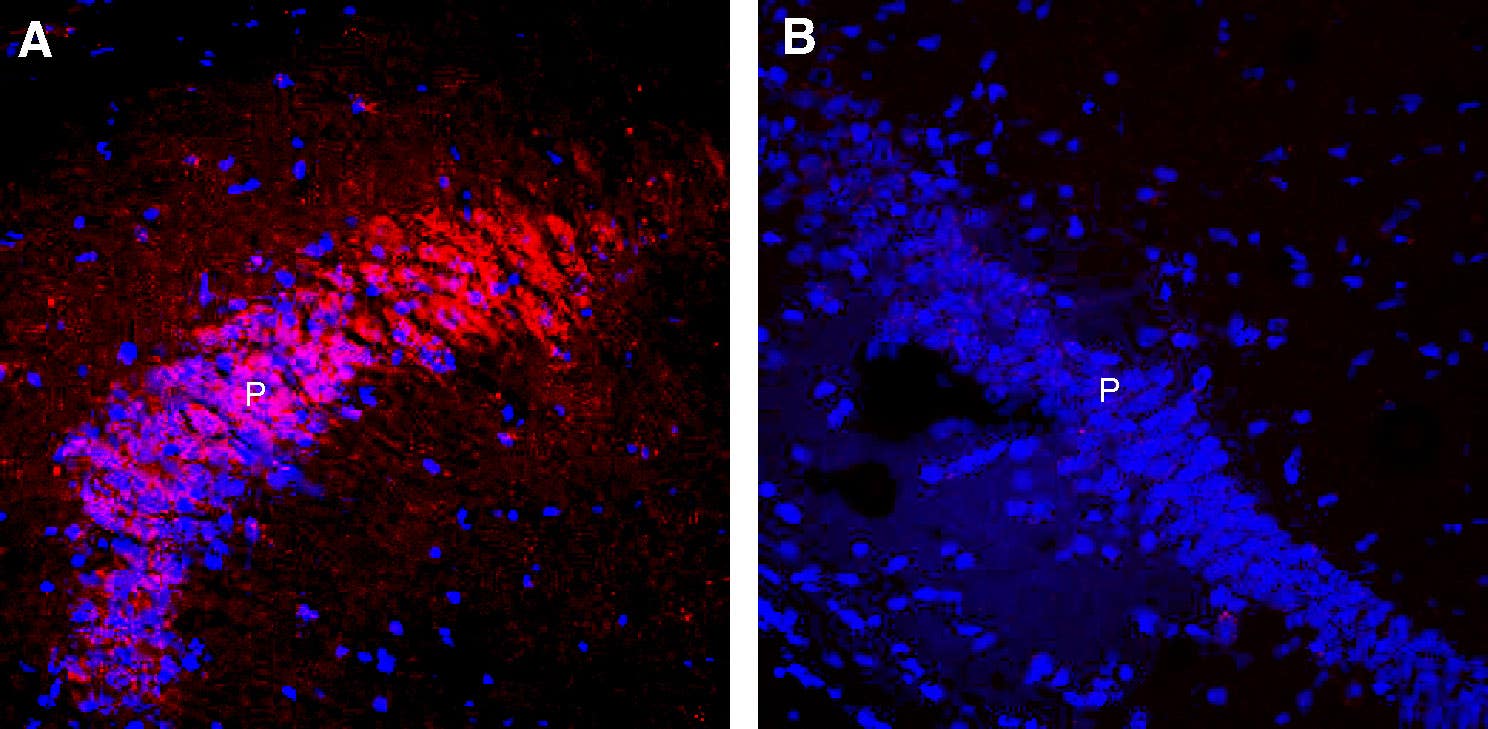 Guinea Pig Anti-Nicotinic Acetylcholine Receptor α7 (CHRNA7) (extracellular) Antibody