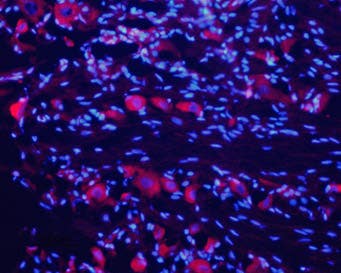 Anti-Nicotinic Acetylcholine Receptor α7 (CHRNA7) (extracellular) Antibody