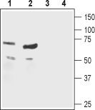Nicotinic Acetylcholine Receptor β1/CHRNB1 (extracellular) Blocking Peptide