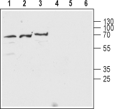 Anti-Nicotinic Acetylcholine Receptor β2 (CHRNB2) (extracellular) Antibody