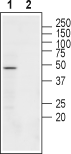 Anti-Nicotinic Acetylcholine Receptor β3 (CHRNB3) (extracellular) Antibody