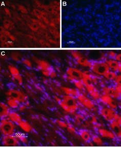 Anti-Nicotinic Acetylcholine Receptor β4 (CHRNB4) (extracellular)-ATTO Fluor-594 Antibody