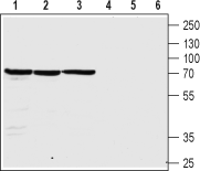 Nicotinic Acetylcholine Receptor β4/CHRNB4 (extracellular) Blocking Peptide