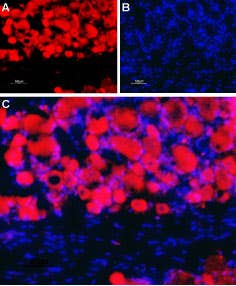Anti-Nicotinic Acetylcholine Receptor β4 (CHRNB4) (extracellular) Antibody
